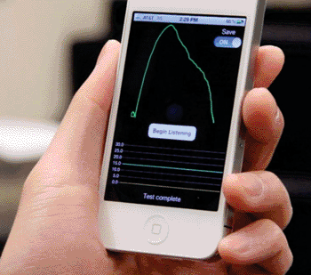 Image: The SpiroSmart mobile phone based spirometry platform (Photo courtesy of the University of Washington).